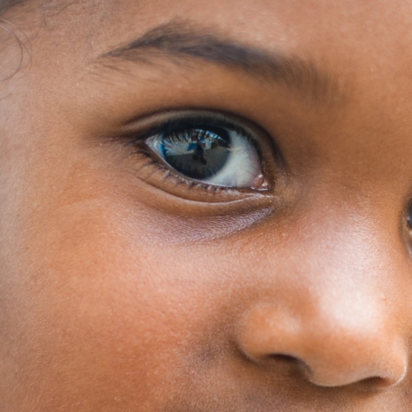 ögoninflammation barn